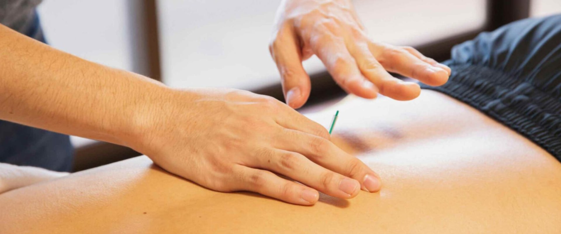 Understanding Acupuncture for Chronic Pain Management