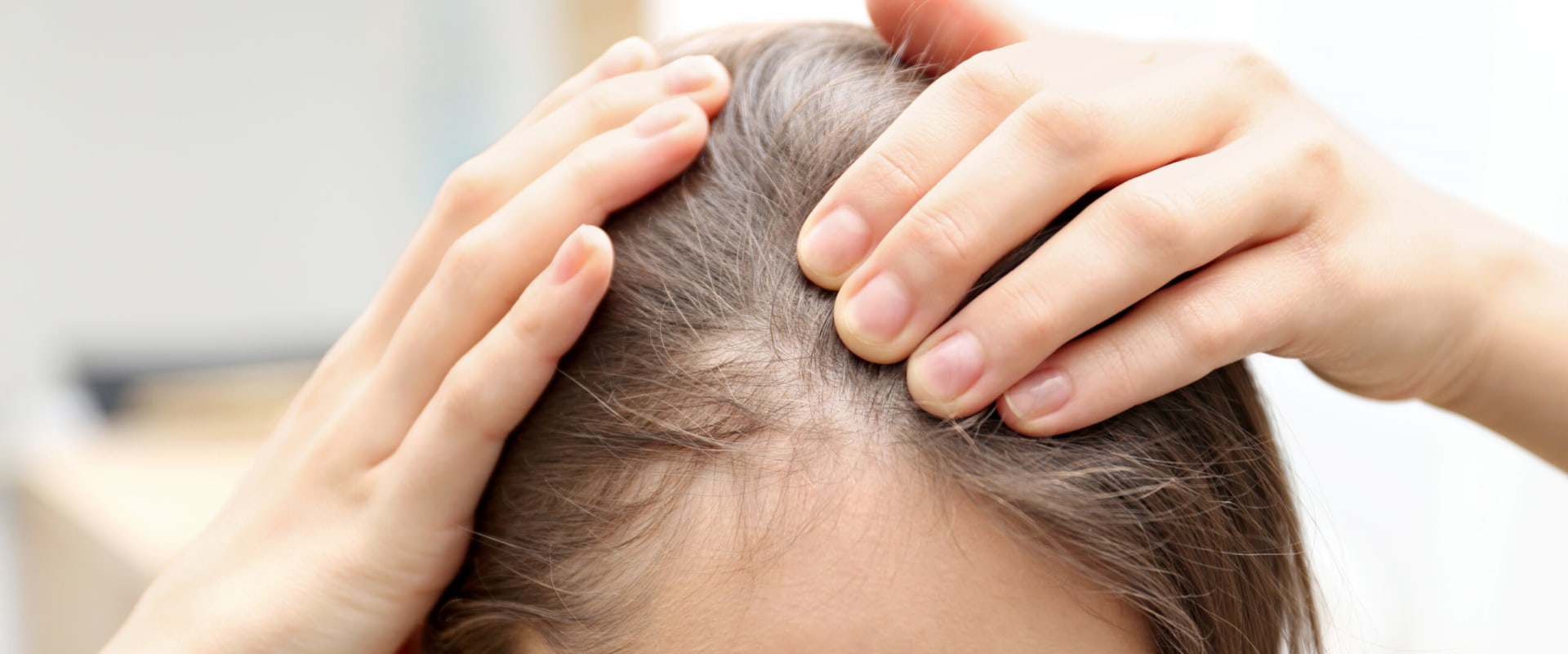 Understanding Medical Conditions and Female Hair Loss