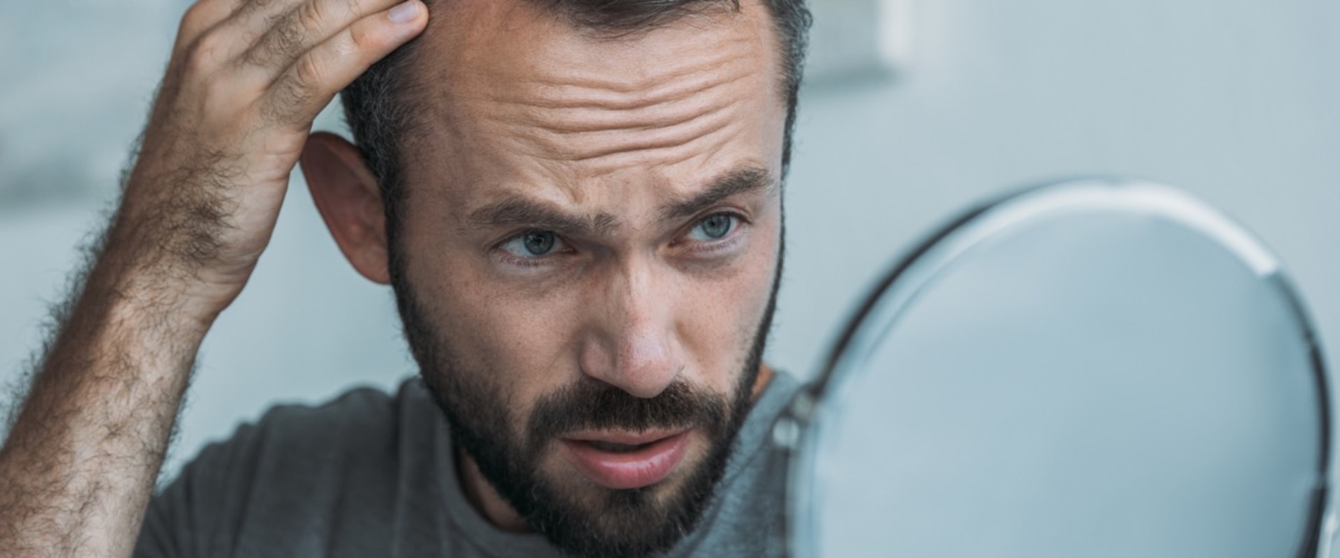 Poor Diet and Hair Loss: How Your Eating Habits Can Affect Your Hair