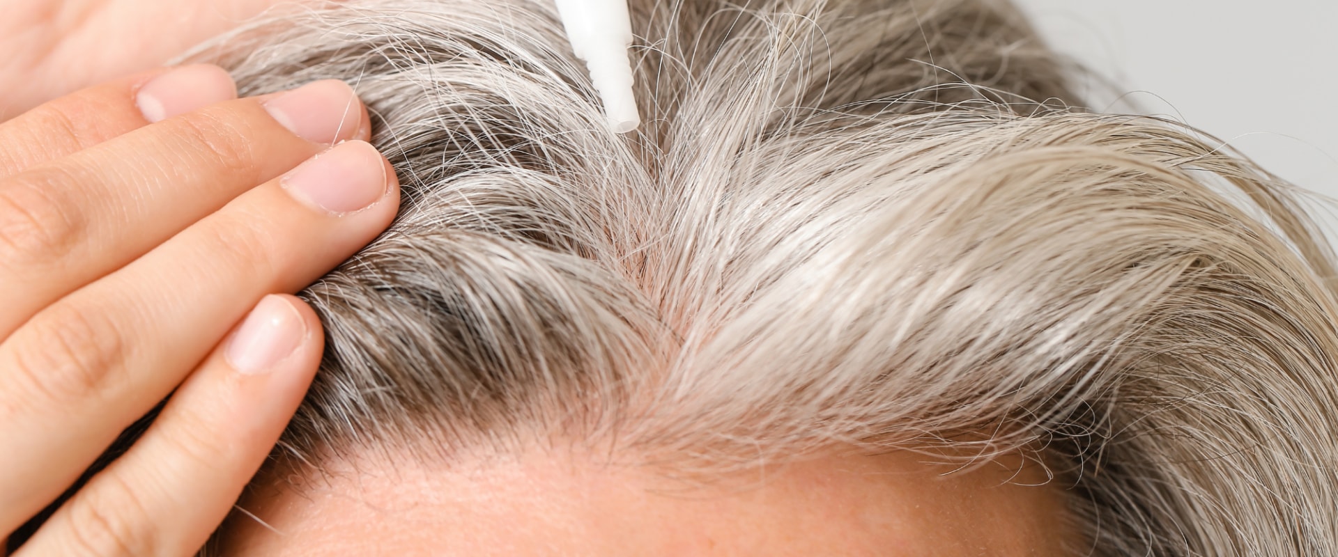 Understanding Minoxidil for Chronic Pain Management