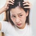 Scalp Treatments for Hair Growth: A Comprehensive Guide