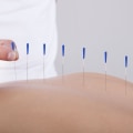 How Acupuncturists Can Help You Manage Chronic Pain