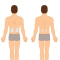 Understanding TENS: A Comprehensive Guide to Pain Management