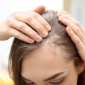 Understanding Medical Conditions and Female Hair Loss