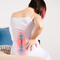 Understanding and Managing Sciatica