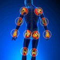 Understanding Joint Pain: Managing Chronic Pain Through Treatment Options and Specialists