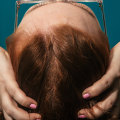 Menopause and Hair Loss: Managing Pain and Hormonal Changes