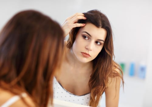 Understanding the Connection between Lifestyle Factors and Female Hair Loss