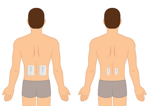 Understanding TENS: A Comprehensive Guide to Pain Management