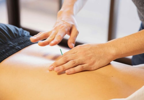 Understanding Acupuncture for Chronic Pain Management