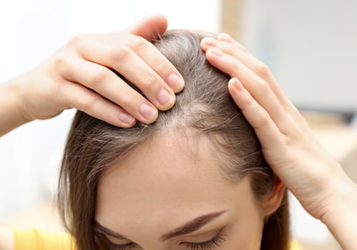 Understanding Medical Conditions and Female Hair Loss