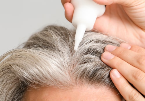 Understanding Minoxidil for Chronic Pain Management